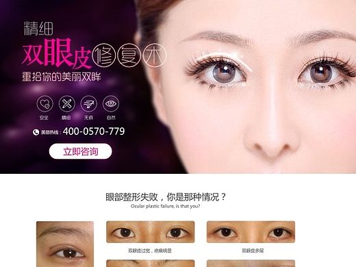 精细双眼皮
