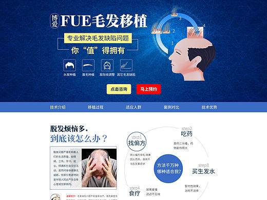 毛发移植PC专题