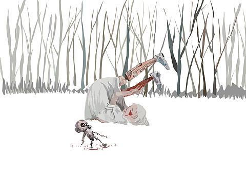 A girl hurts her legs(待补充)