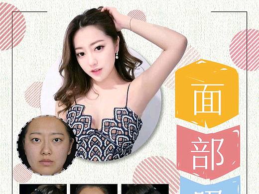 整形美容专题