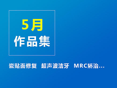 牙科专题  儿童MRC矫治 超声波洁牙 H5活动页面