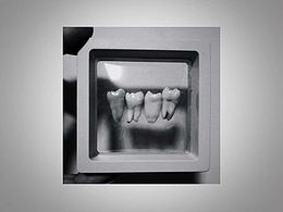 我的牙齒真可愛??