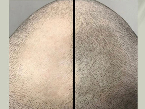 西安紋發(fā).陜西紋發(fā)佳佳刺青寶雞紋發(fā) 銅川紋發(fā)（個人主頁-ZNjAyMTgyMjQ=） - 其他 - 站酷設(shè)計師西安紋身佳佳刺青原創(chuàng)素材 - 站酷ZCOOL