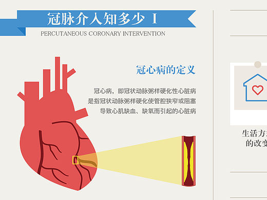 吉威医疗信息图