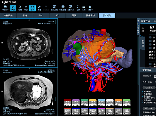 志御dicom-viewer（個人主頁-ZNjYwMzA3MDA=） - APP界面 - 站酷設(shè)計師邢妍原創(chuàng)素材 - 站酷ZCOOL