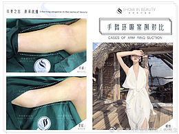 整形案例-品牌定制风