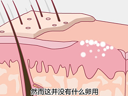 疤痕贴卡通视频