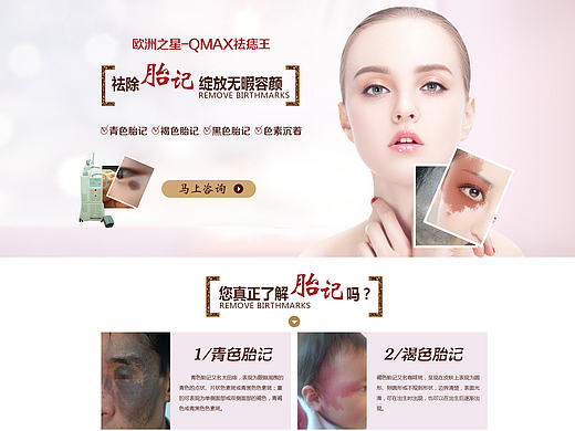 祛胎记专题