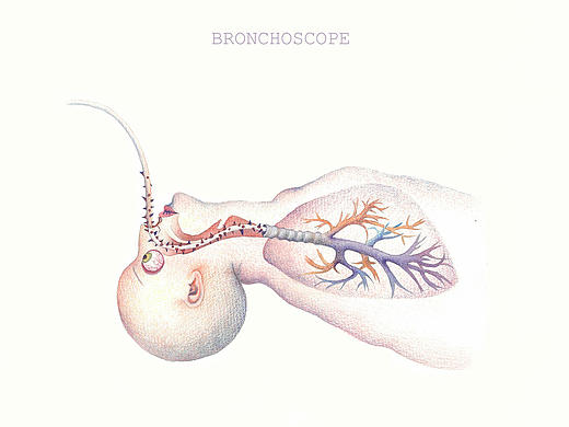 关于器官手术想象的一系列（个人主页-ZMjUyOTU1MzY=） - 创作习作 - 站酷设计师邓米奇V原创素材 - 站酷ZCOOL