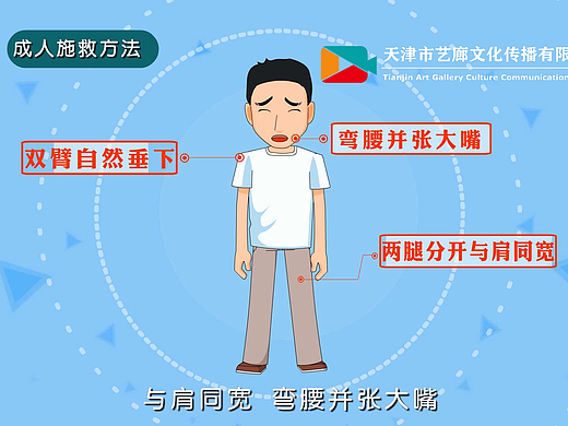 异物梗阻处理二维动画如何制作