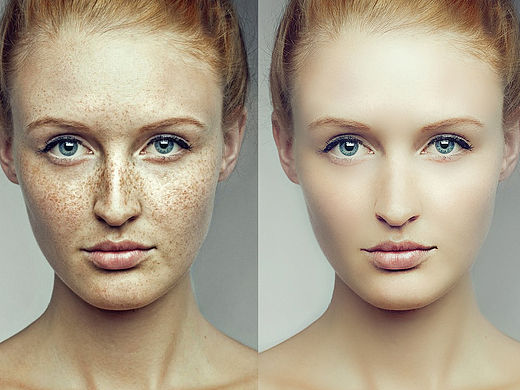 修图-祛斑（个人主页-ZMTQzODk4MzY=） - 其他平面 - 站酷设计师橘子与夏原创素材 - 站酷ZCOOL