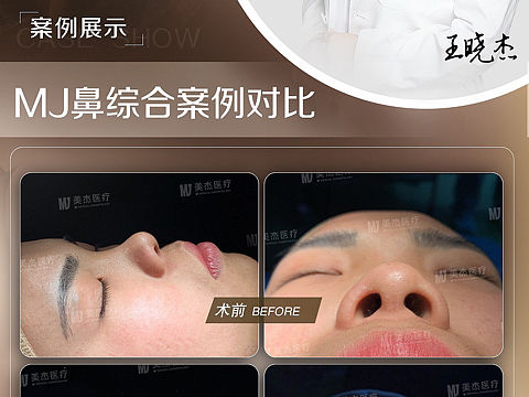 医美