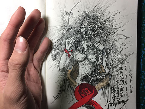 艾滋病