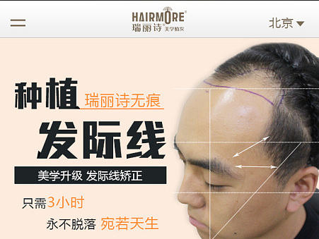 移动端网页设计 医疗植发