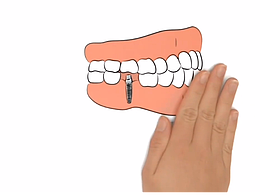 特别的科普手势定格动画