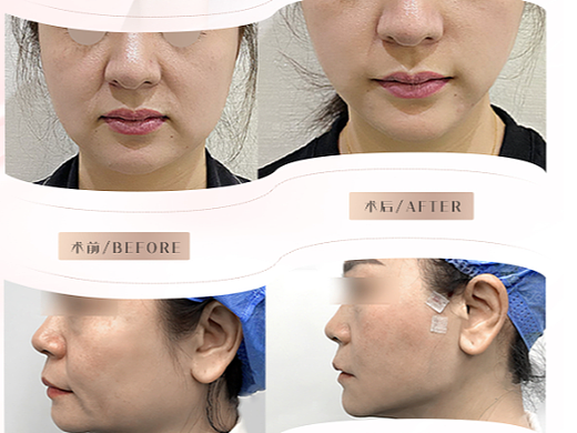 医美案例系列海报（个人主页-ZNjA1NDczMzY=） - 海报 - 站酷设计师与鹿Q原创素材 - 站酷ZCOOL