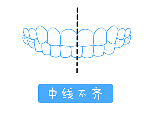 牙齿类型（个人主页-ZNjU5MDExODQ=） - 图案 - 站酷设计师齐齐姐原创素材 - 站酷ZCOOL