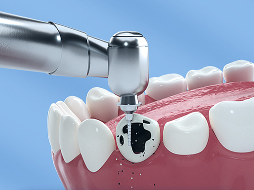 補(bǔ)牙詳情頁（個(gè)人主頁-ZNjAyODQyODQ=） - 電商 - 站酷設(shè)計(jì)師塔米615原創(chuàng)素材 - 站酷ZCOOL