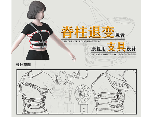 脊柱退变患者康复用支具设计