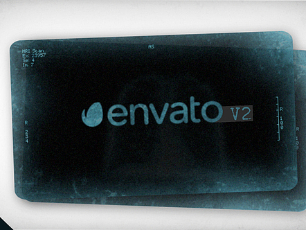 AE模板|独特X射线医疗包动画视频展示医疗研发团队宣传