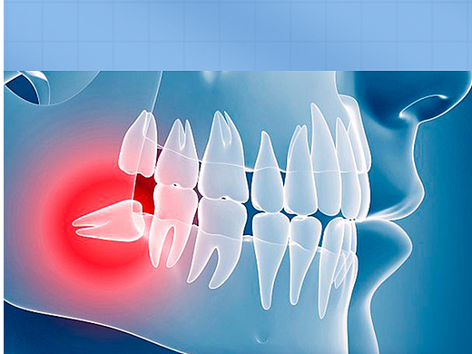 拔牙詳情頁（個(gè)人主頁-ZNjAyODQzNjA=） - 電商 - 站酷設(shè)計(jì)師塔米615原創(chuàng)素材 - 站酷ZCOOL
