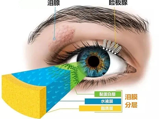 成都爱尔李晓峰主任:眼睛干到发出求救信号,快注意!