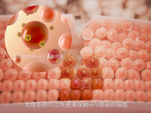 小匠视觉作品案例——万泰HPV疫苗