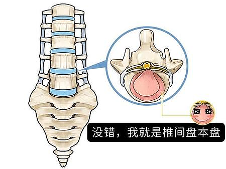腰椎手术护理mg动画是如何制作的呢
