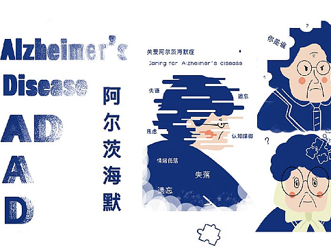 《阿尔茨海默症》