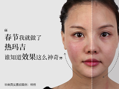 皮肤案例海报