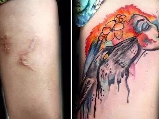 剖腹产过后在疤痕上纹身东湖塘纹身店的这组图片美爆了
