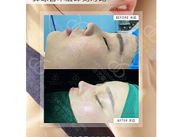 医美案例10