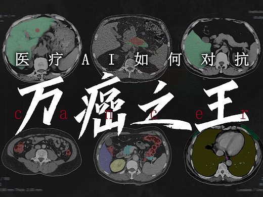 【客户案例】阿里达摩院《医疗AI如何对抗万癌之王》