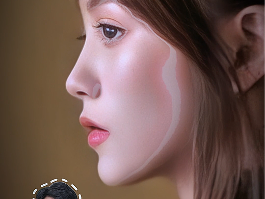 医美科普4