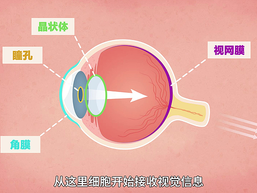 二维动画MG动画医疗动画-眼部医学-优趣文化