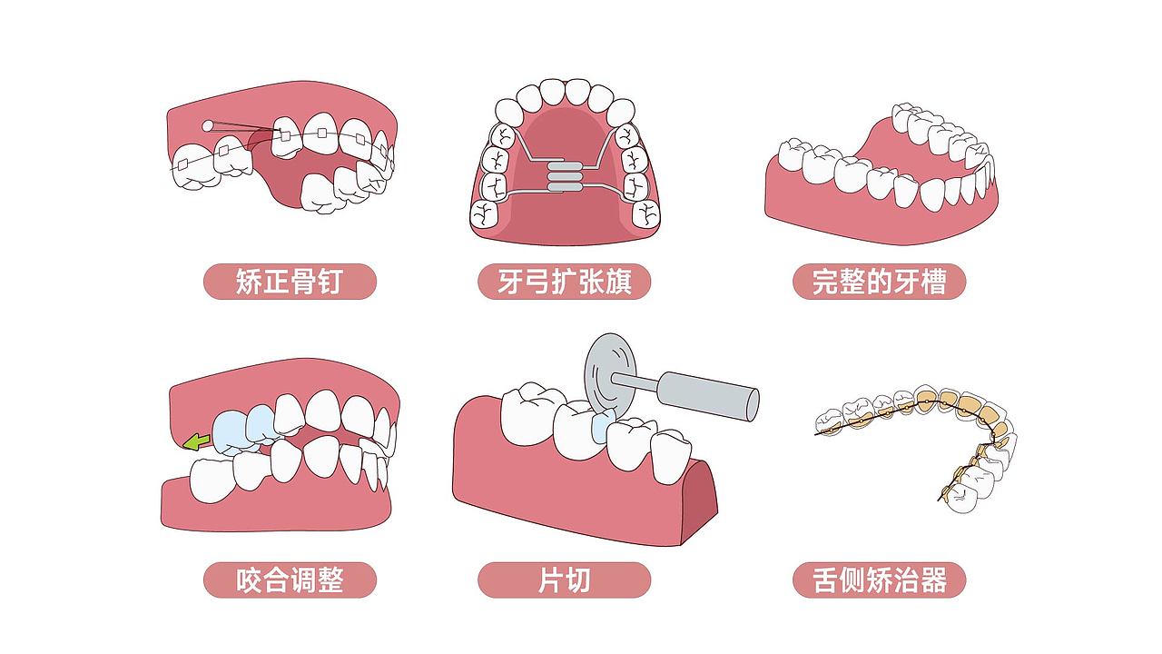 口腔专用插图01（图ZMzc2NDc3ODgw） - 商业插画 - 站酷设计师大尧水瓶座原创素材 - 站酷ZCOOL