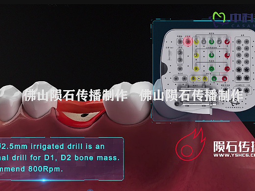 高科技牙科三维动画展示，让治疗更清晰