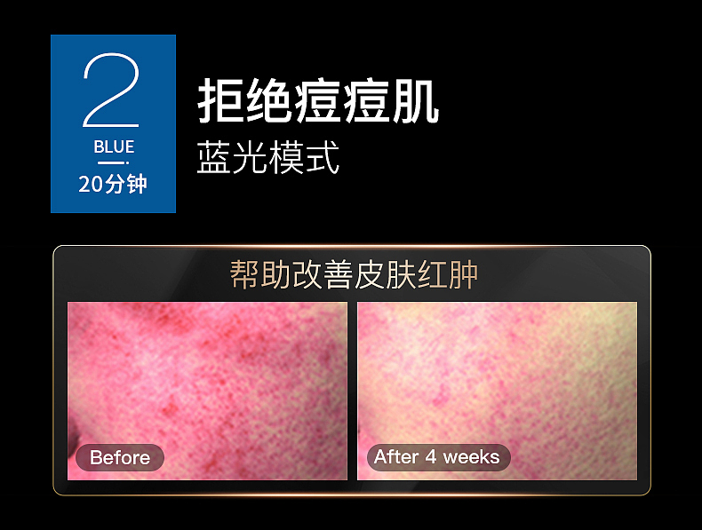 光子嫩肤仪详情页