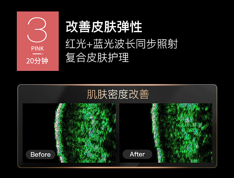 光子嫩肤仪详情页