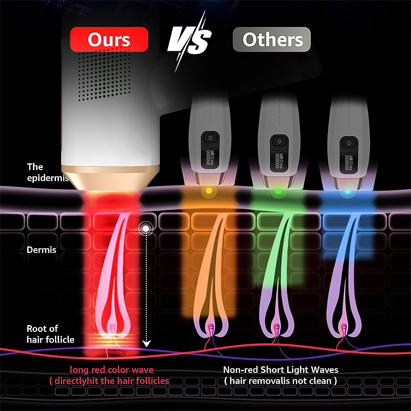 脱毛仪（图ZMzc5Njc2ODk2） - 电商 - 站酷设计师住在梦边上原创素材 - 站酷ZCOOL