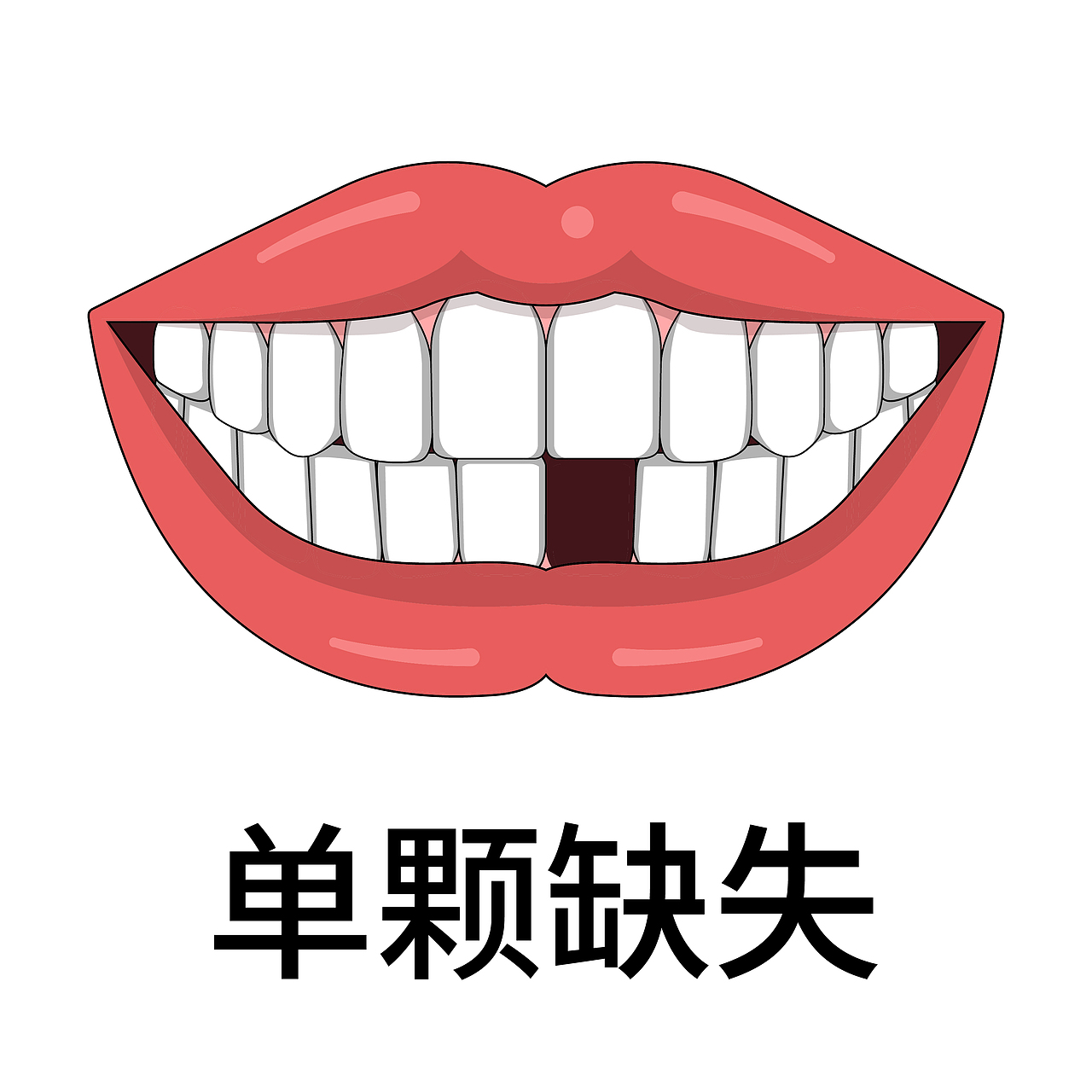 口腔 牙齿插画 种植牙 牙齿类型 牙齿缺失