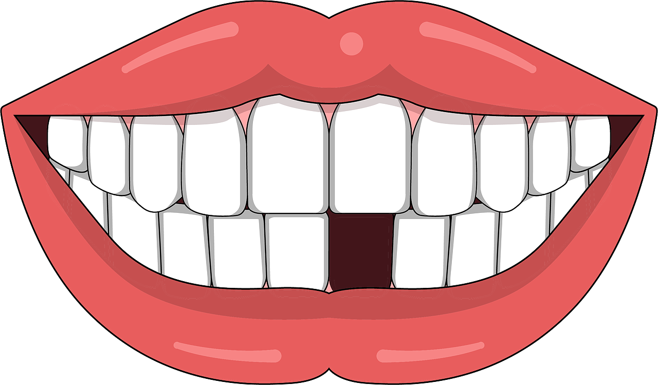 口腔 牙齿插画 种植牙 牙齿类型 牙齿缺失