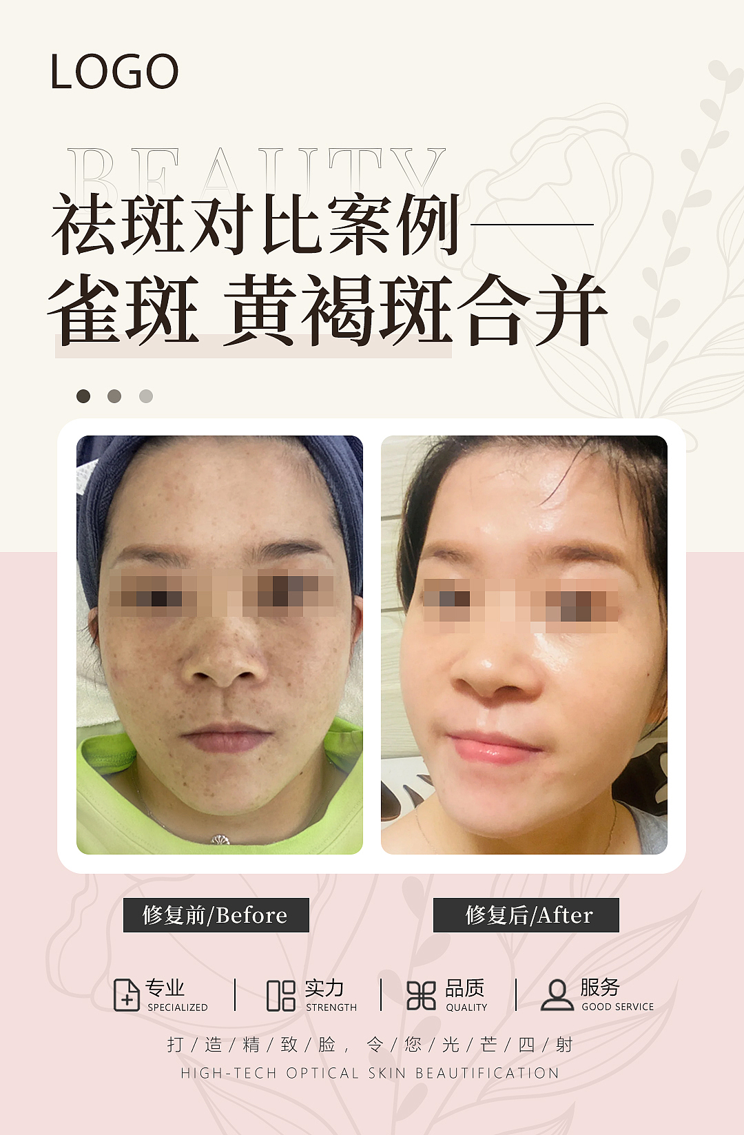 医美案例对比海报