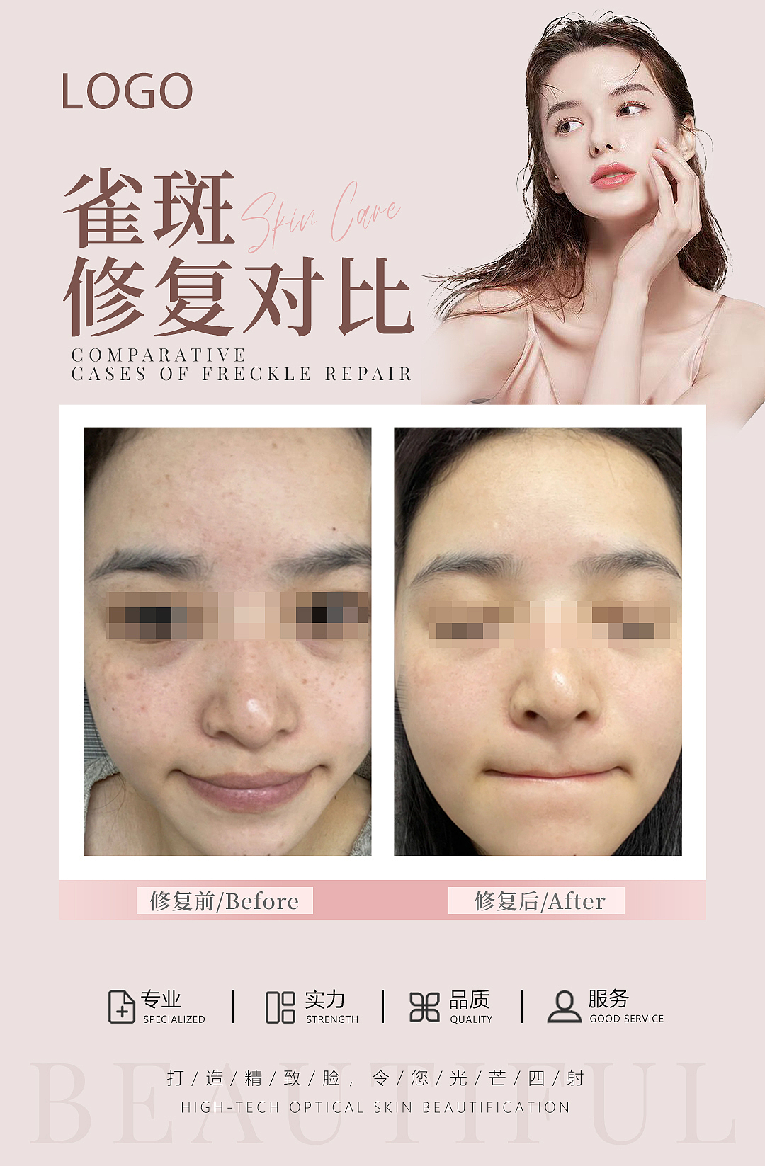 美业案例对比效果图