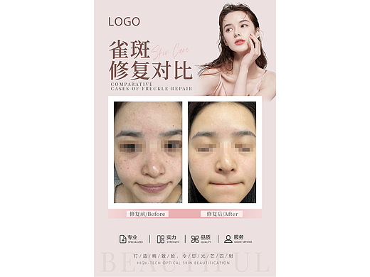 美业案例对比效果图