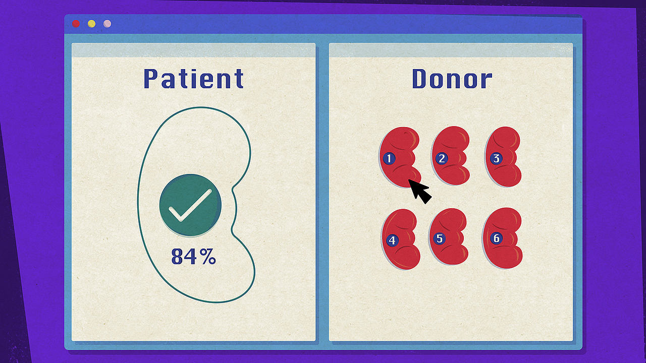 【TED-Ed】肾移植 科普动画
