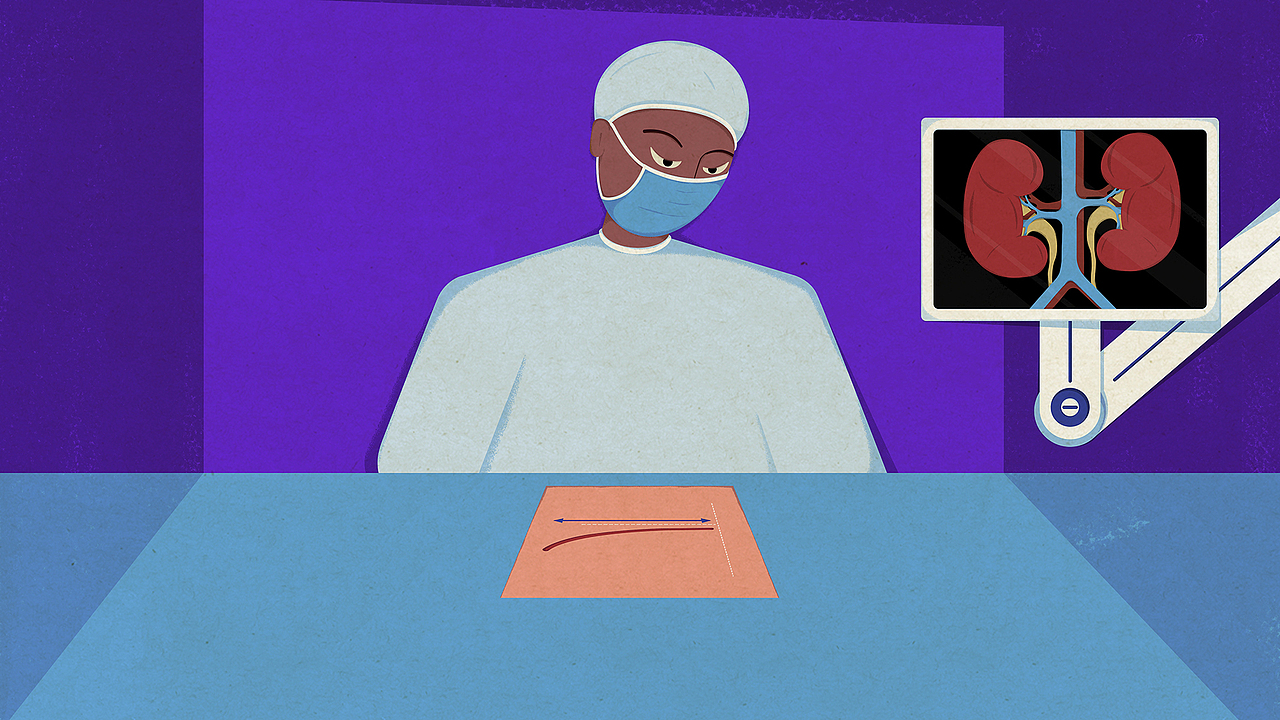 【TED-Ed】肾移植 科普动画