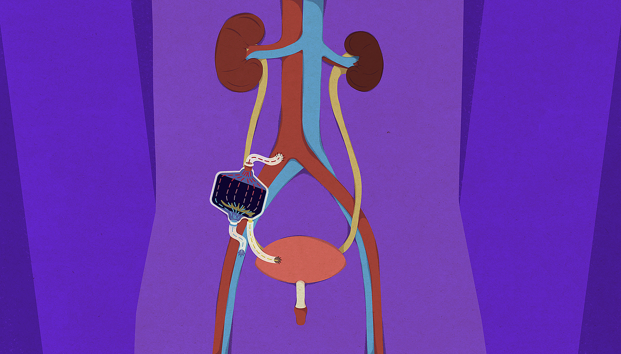 【TED-Ed】肾移植 科普动画