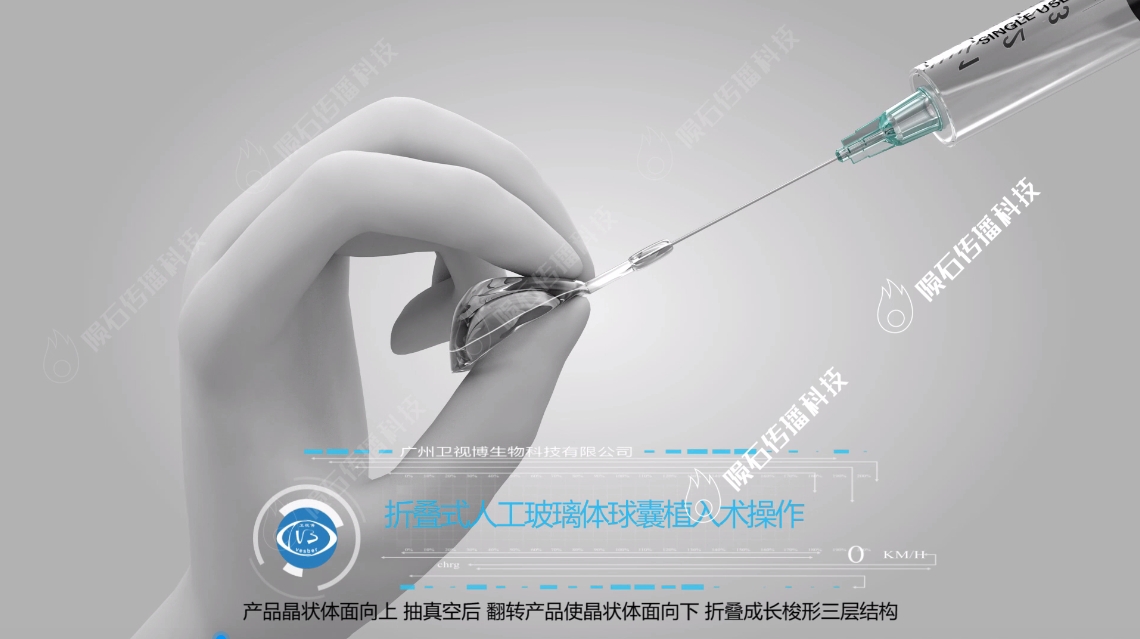 外科手術(shù)3D動(dòng)畫：精準(zhǔn)呈現(xiàn)，助力醫(yī)療新篇章（圖ZMTQ5NTUyMzI=） - 教程 - 站酷設(shè)計(jì)師隕石傳播3D單單原創(chuàng)素材 - 站酷ZCOOL