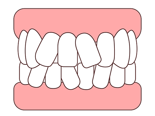 口腔 医美 牙齿类型 矫正 种植 卡通牙齿 牙齿轮廓